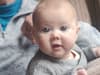 Nottinghamshire tot's 'beautiful' big blue eyes actually symptom of condition causing blindness